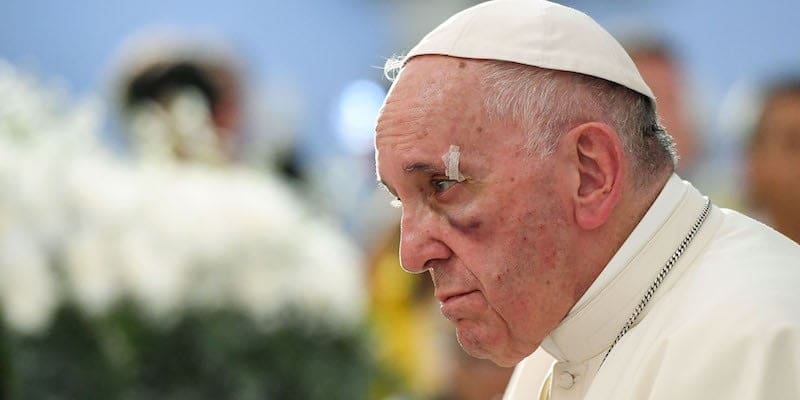 C’è un’altra chiave di lettura sulle dimissioni di massa dei vescovi cileni ?